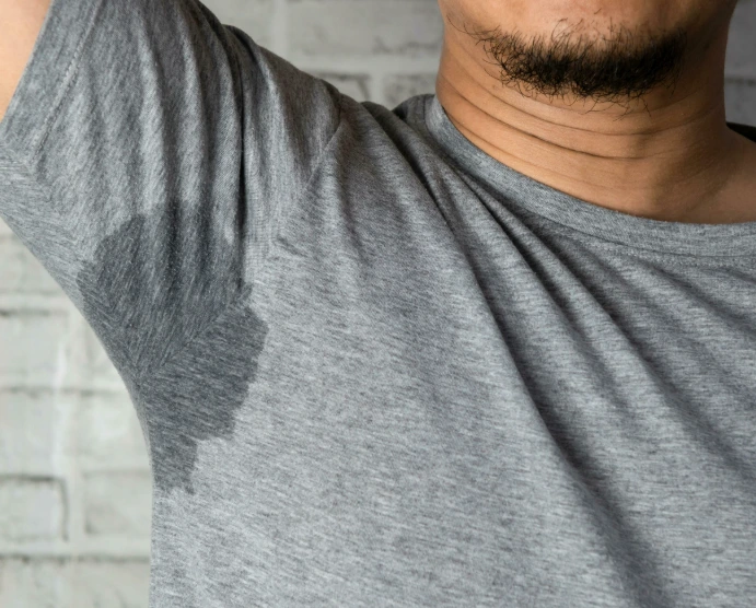 Hidroxa hyperhidrosis quiz for excessive sweating symptom check
